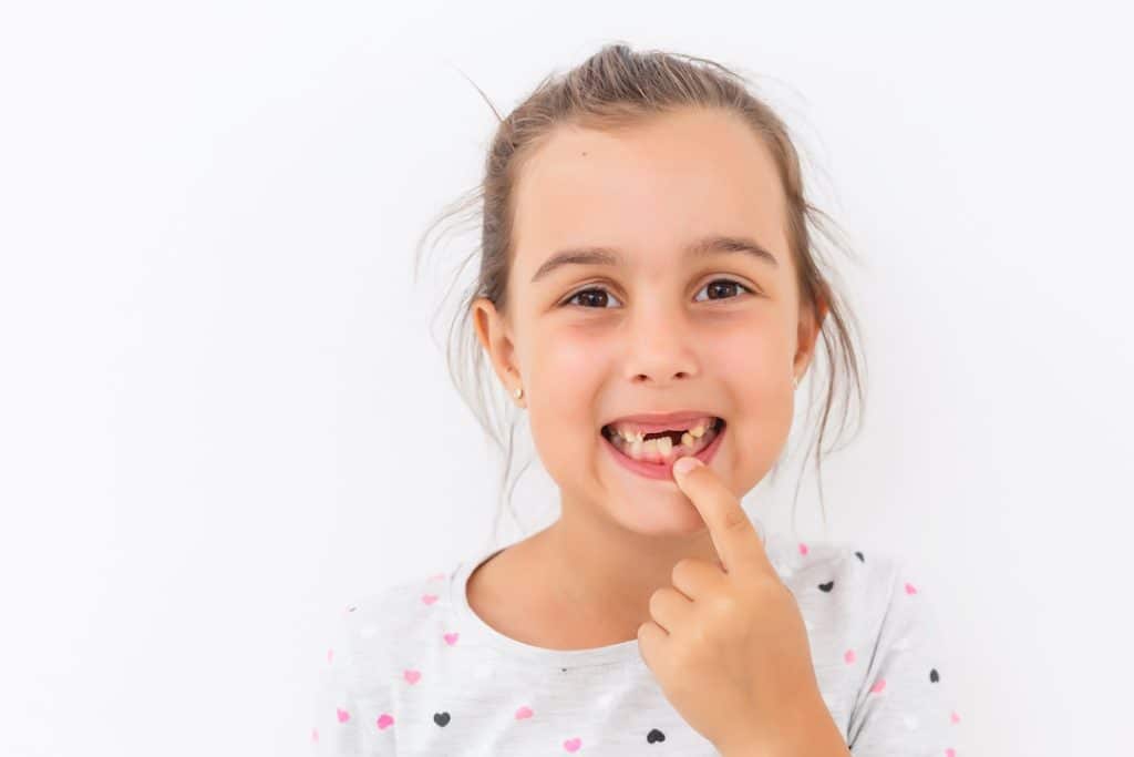 Primary Teeth Extraction
